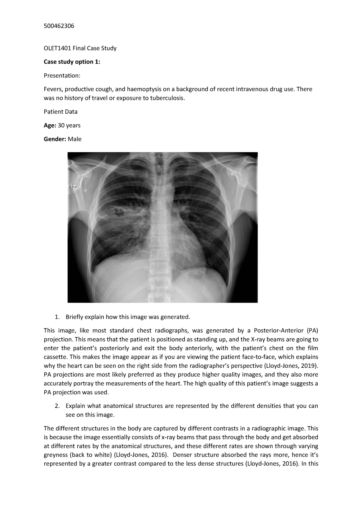 case study x ray