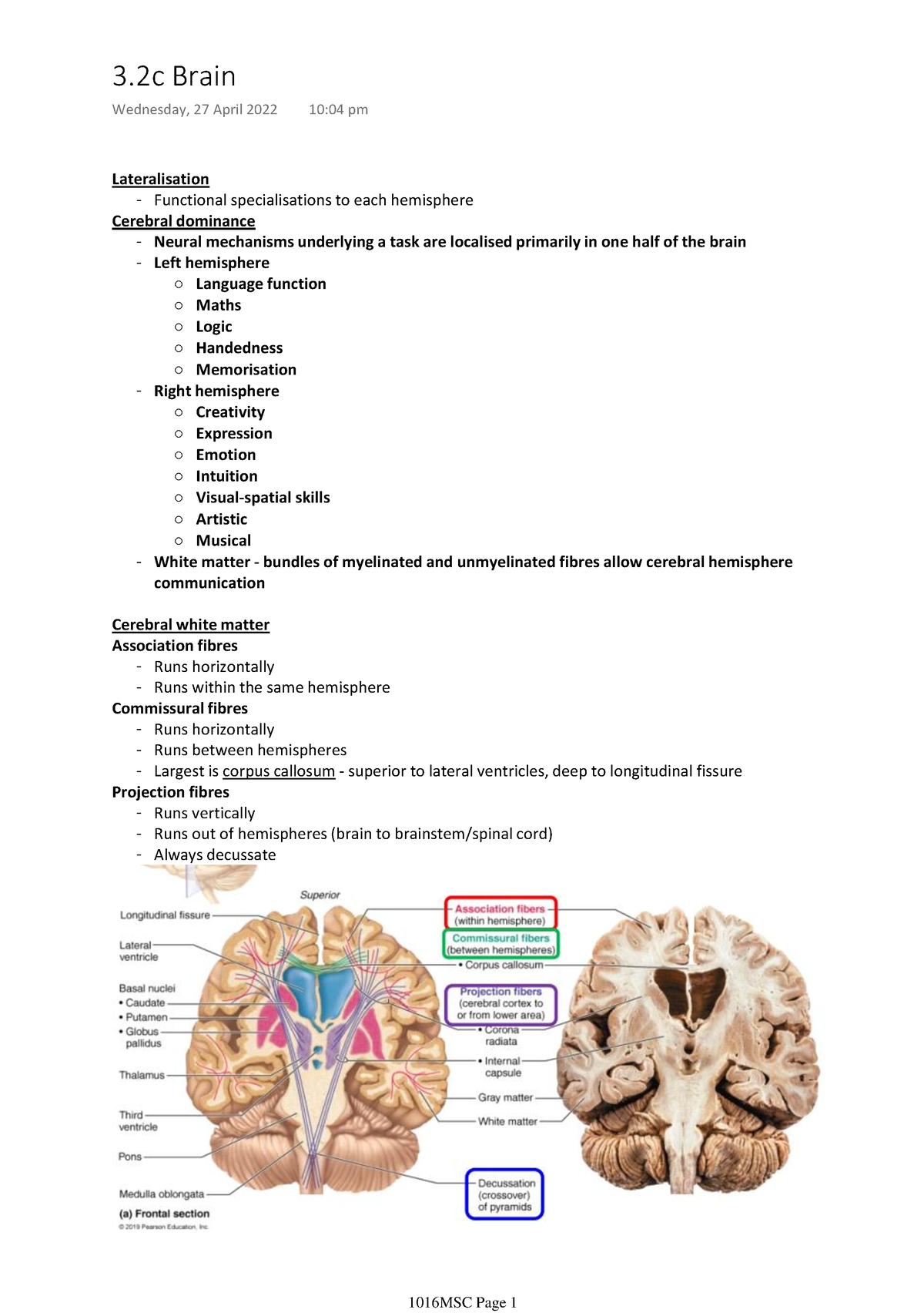 3.2c Brain - Lateralisation - Functional Specialisations To Each 