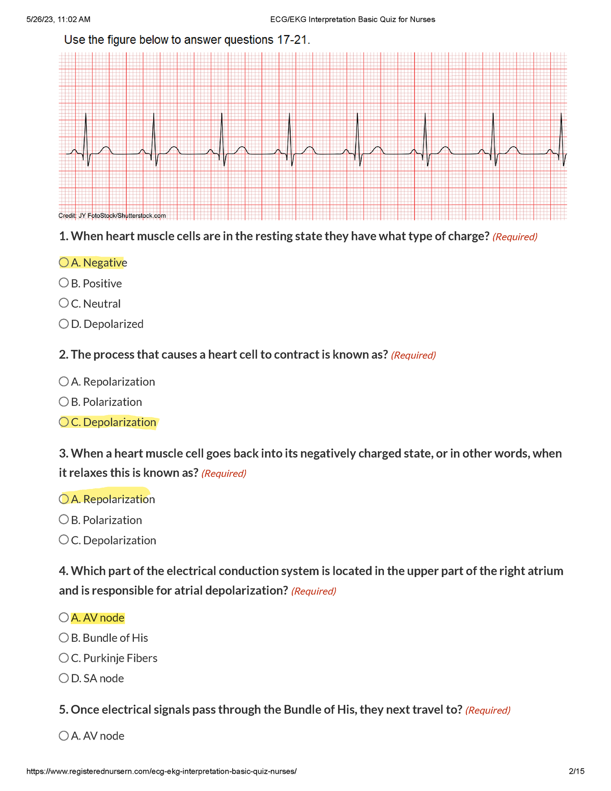 EKG Interpretation for Nurses