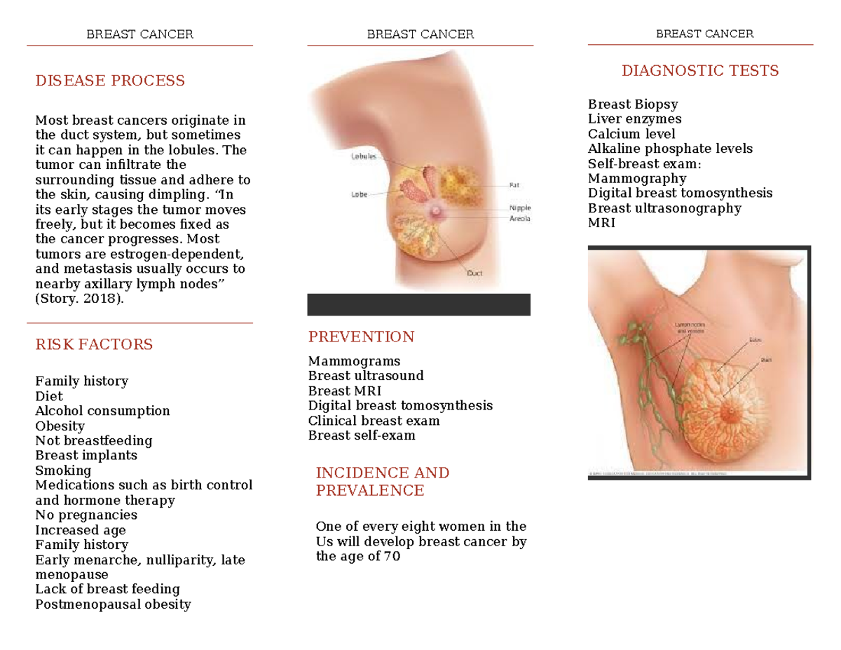 Breast Cancer Brochure - BREAST CANCER DISEASE PROCESS Most breast ...