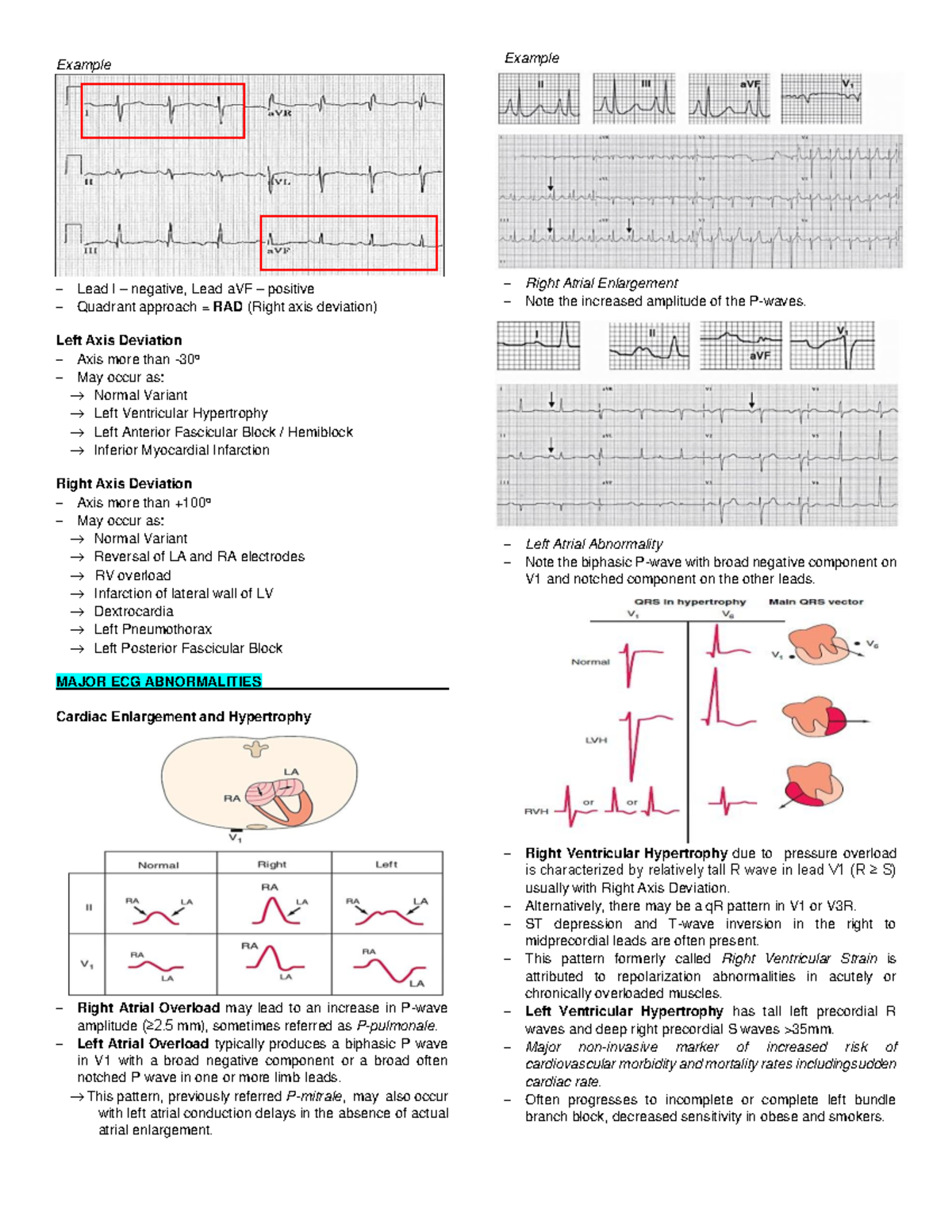 Myocardial Infarction and Cardio-Electrocardiography - Example − Lead I ...