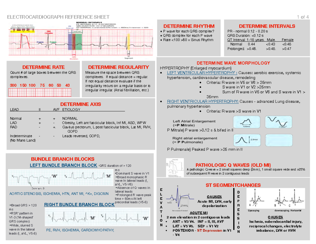 EKG Handouts - DETERMINE RATE Count # of large boxes between the QRS ...