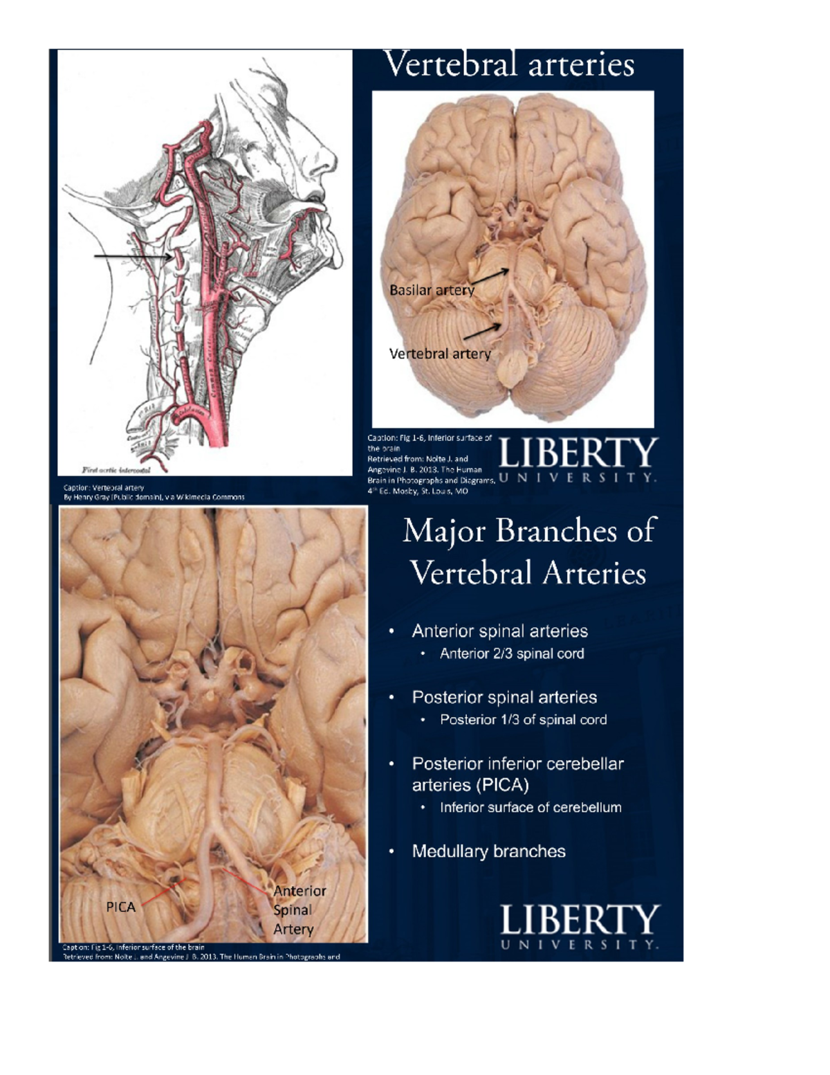 Cerebrovascular System PowerPoint Notes - BIOM 610 - Studocu