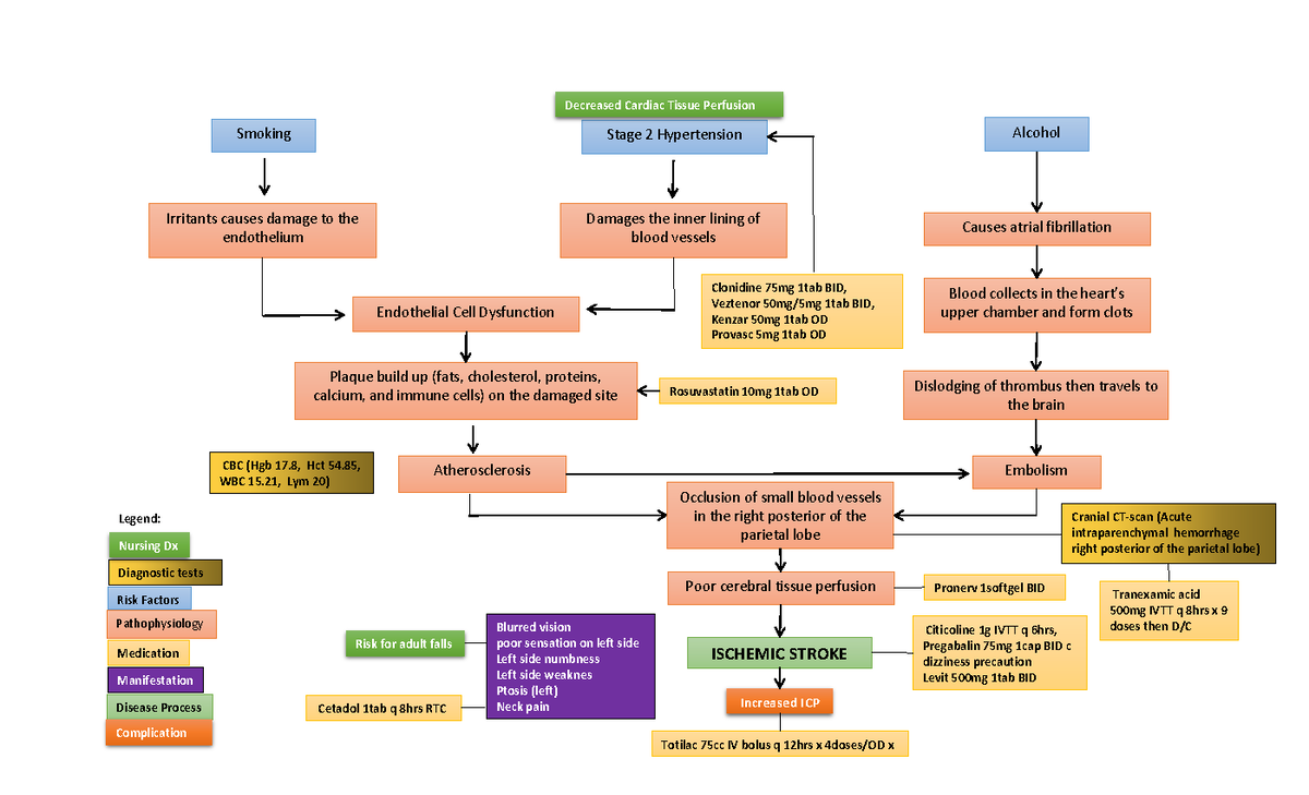 Concept Map (Ischemic Stroke) - Smoking Stage 2 Hypertension Alcohol ...