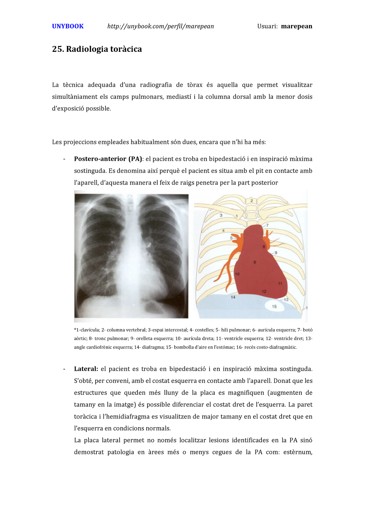 25 Radiologia De Torax Studocu