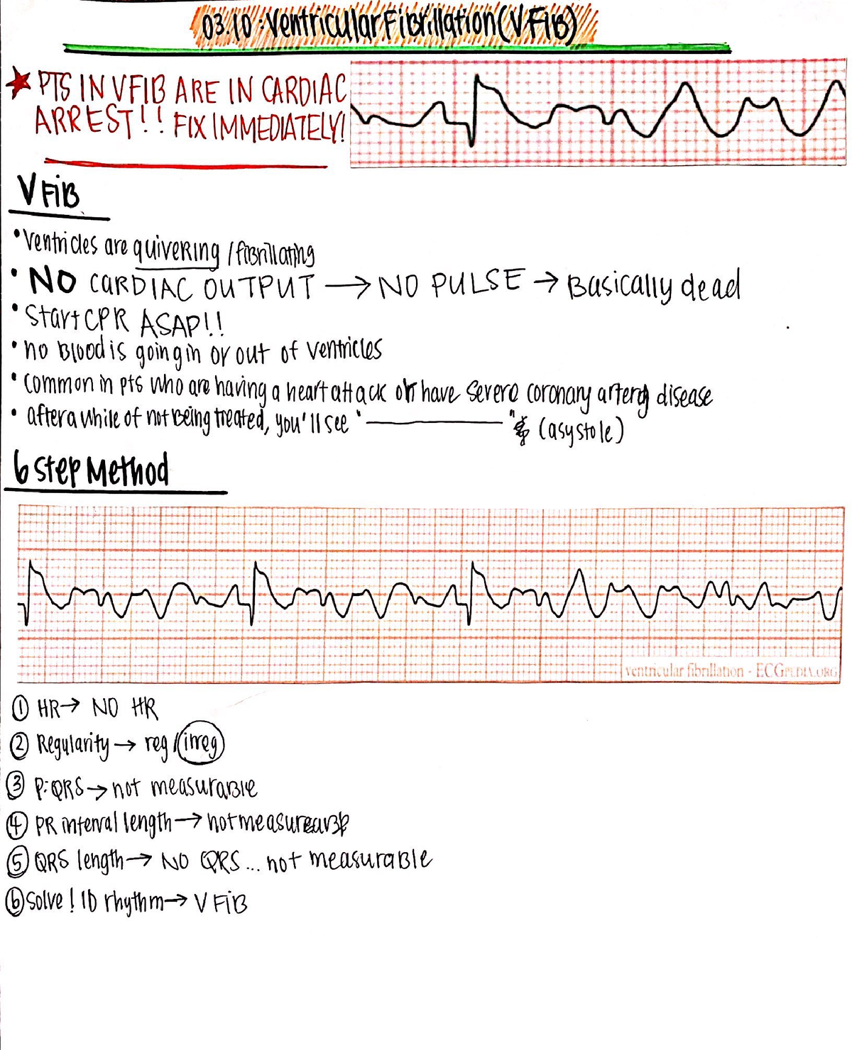 EKG V Fib Notes - NR341 - Studocu