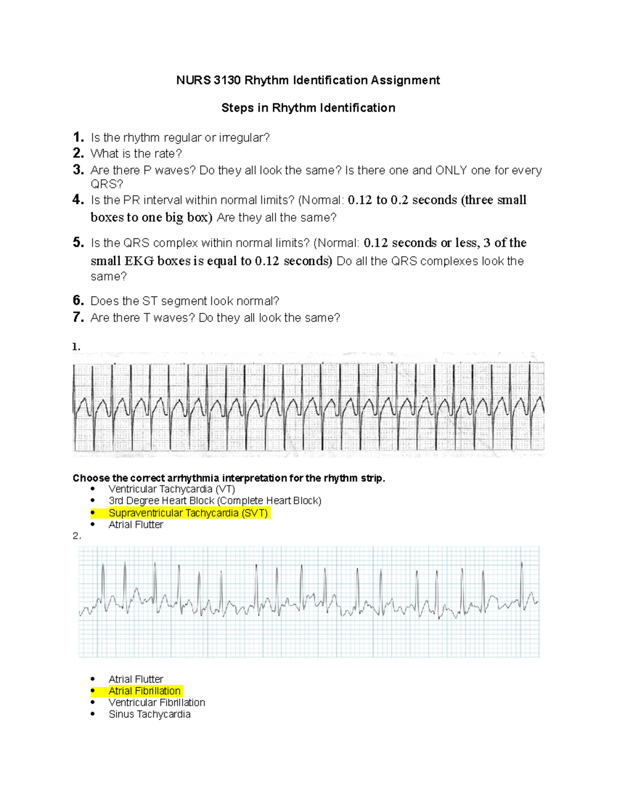 NURS3130 Heart Rhythm NURS 3130 Rhythm Identification Assignment   Thumb 1200 1553 