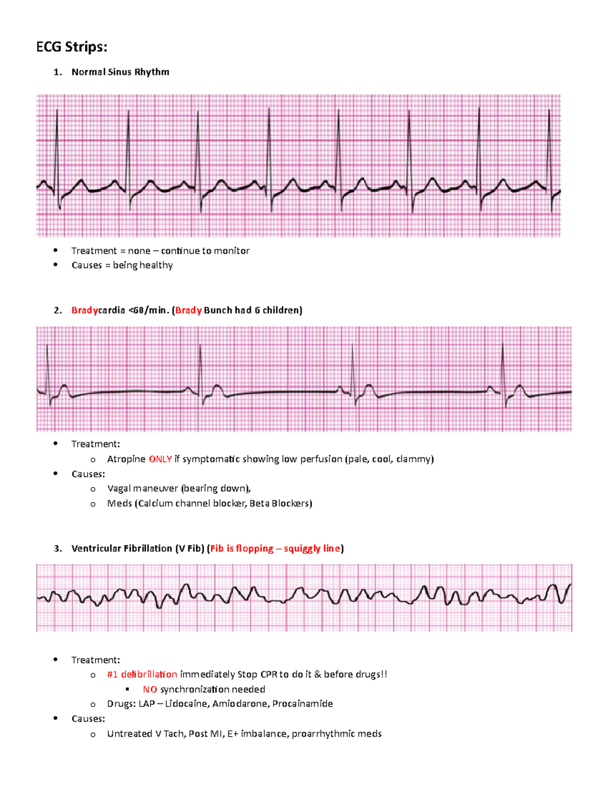 Advanced nursing Exam 2 Simple Nursing - ECG Strips: Normal Sinus ...