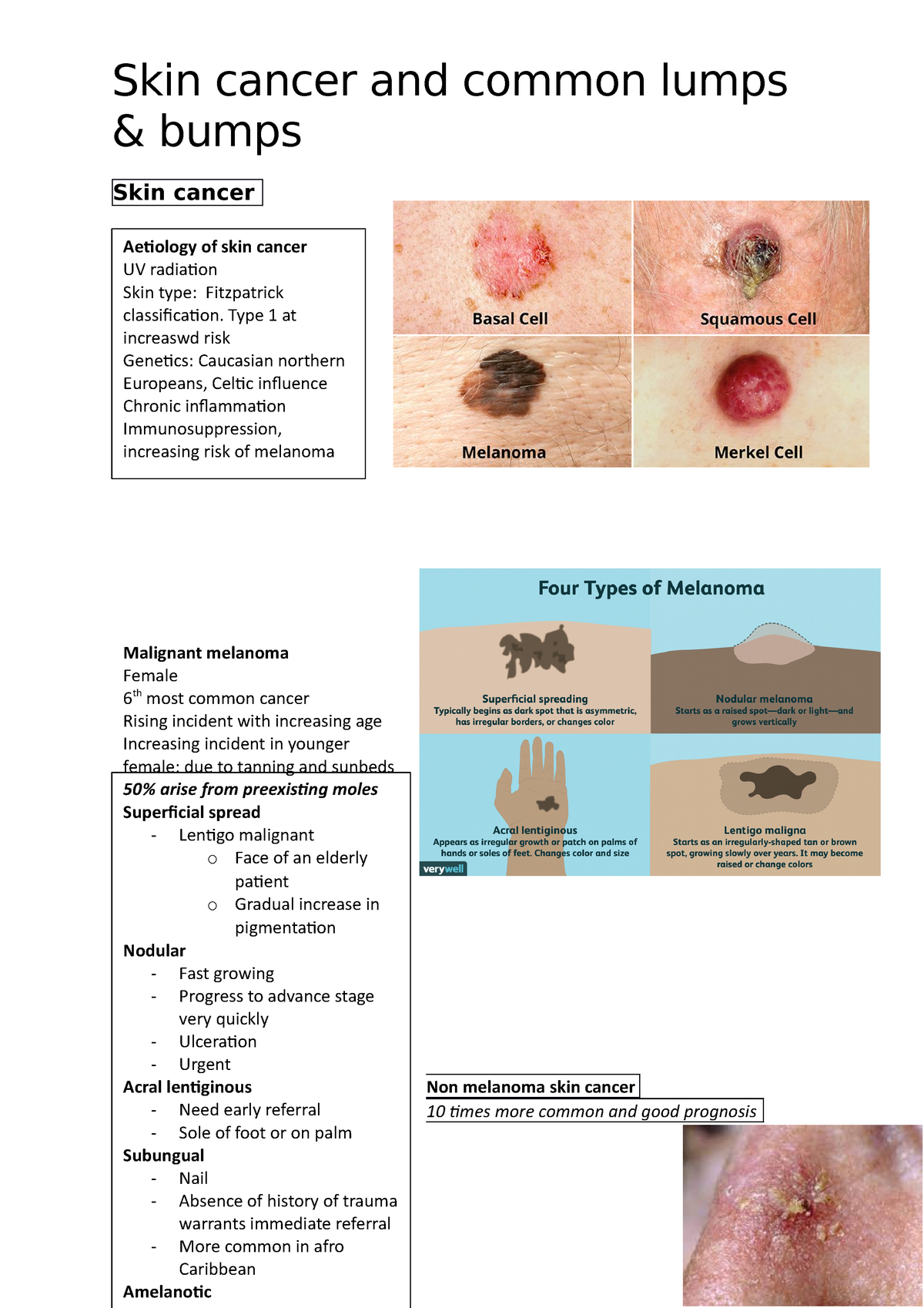 Skin cancer and skin lumps and bumps - & bumps Skin cancer Non melanoma ...