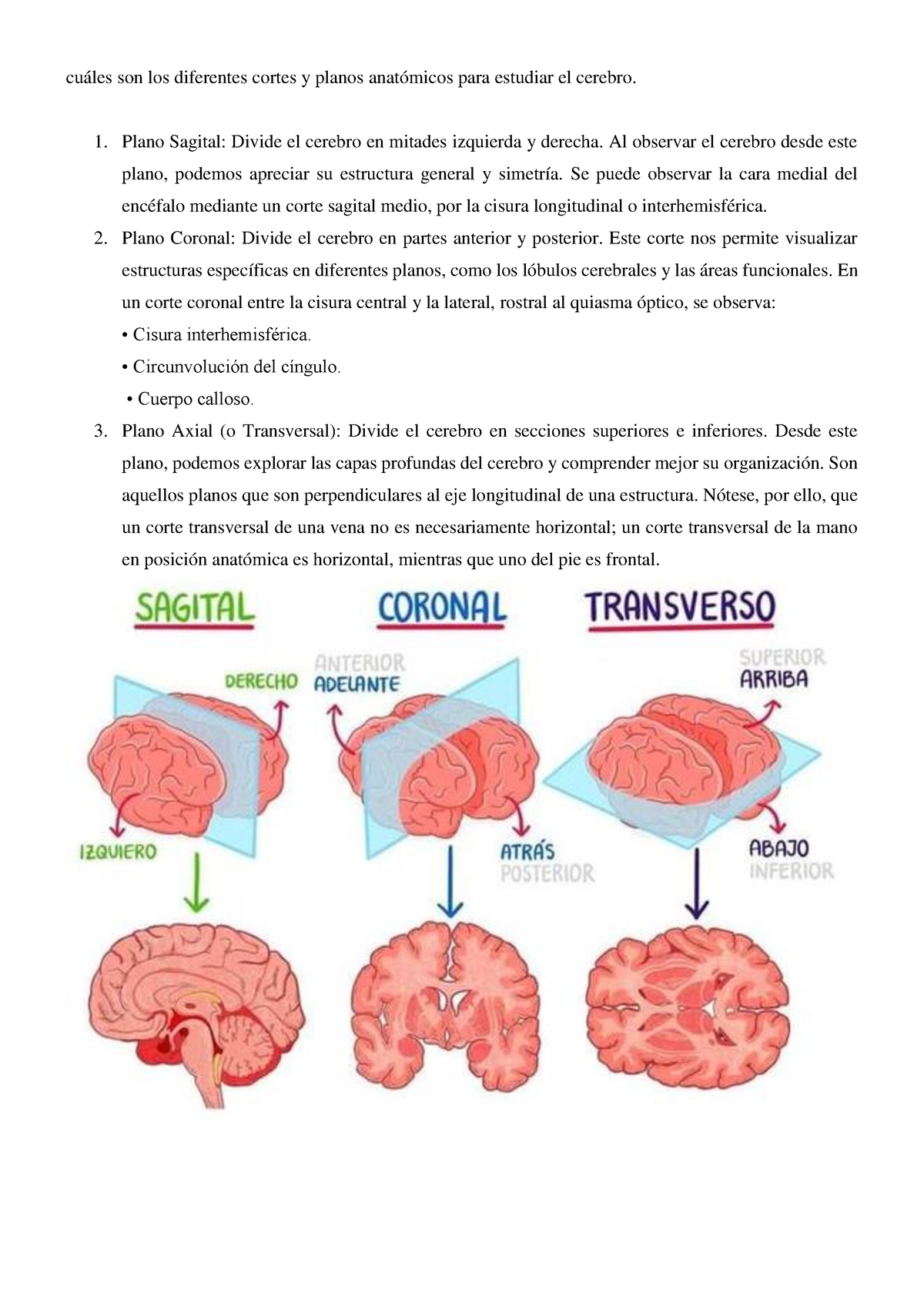 cerebro plano axial