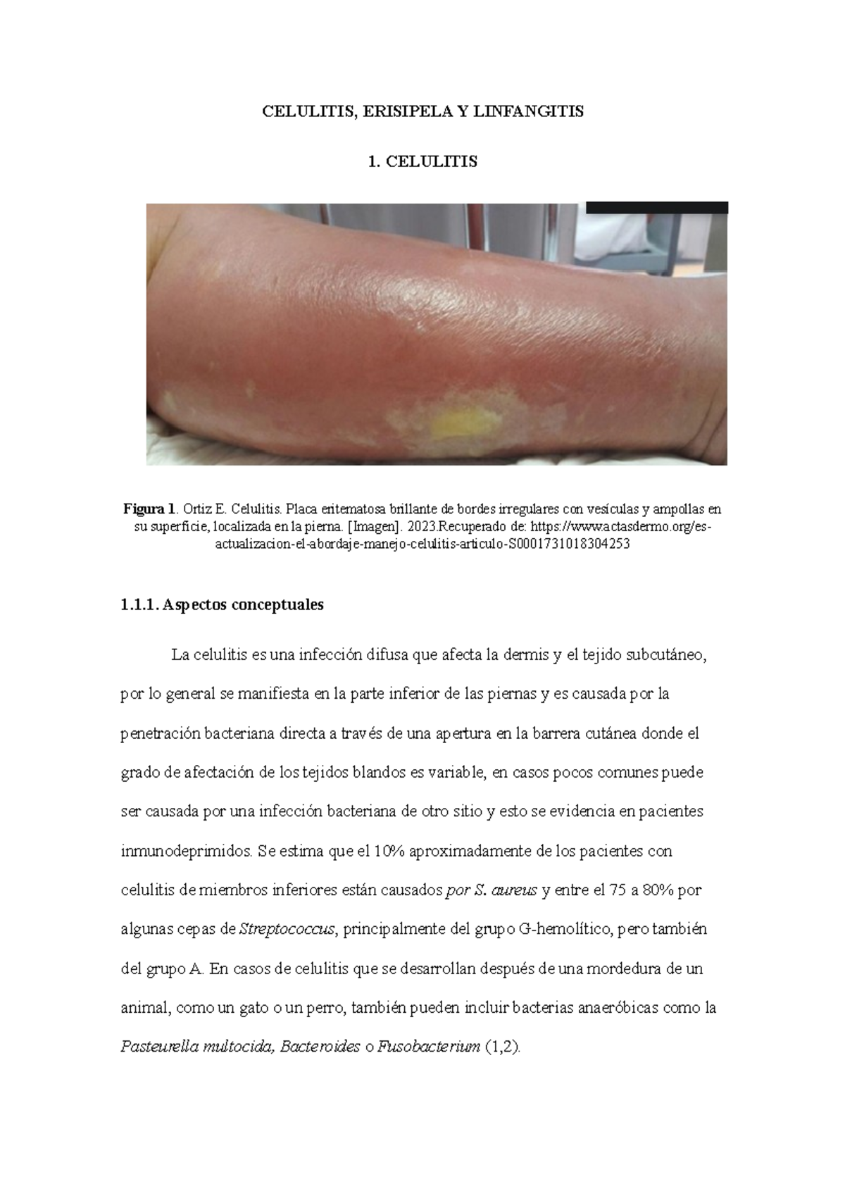 Celulitis, Linfangitis y Erisipela - CELULITIS, ERISIPELA Y LINFANGITIS ...