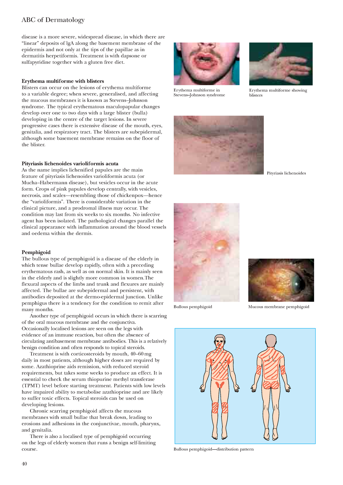 Dermatology-17 - Dermatology - Disease Is A More Severe, Widespread 