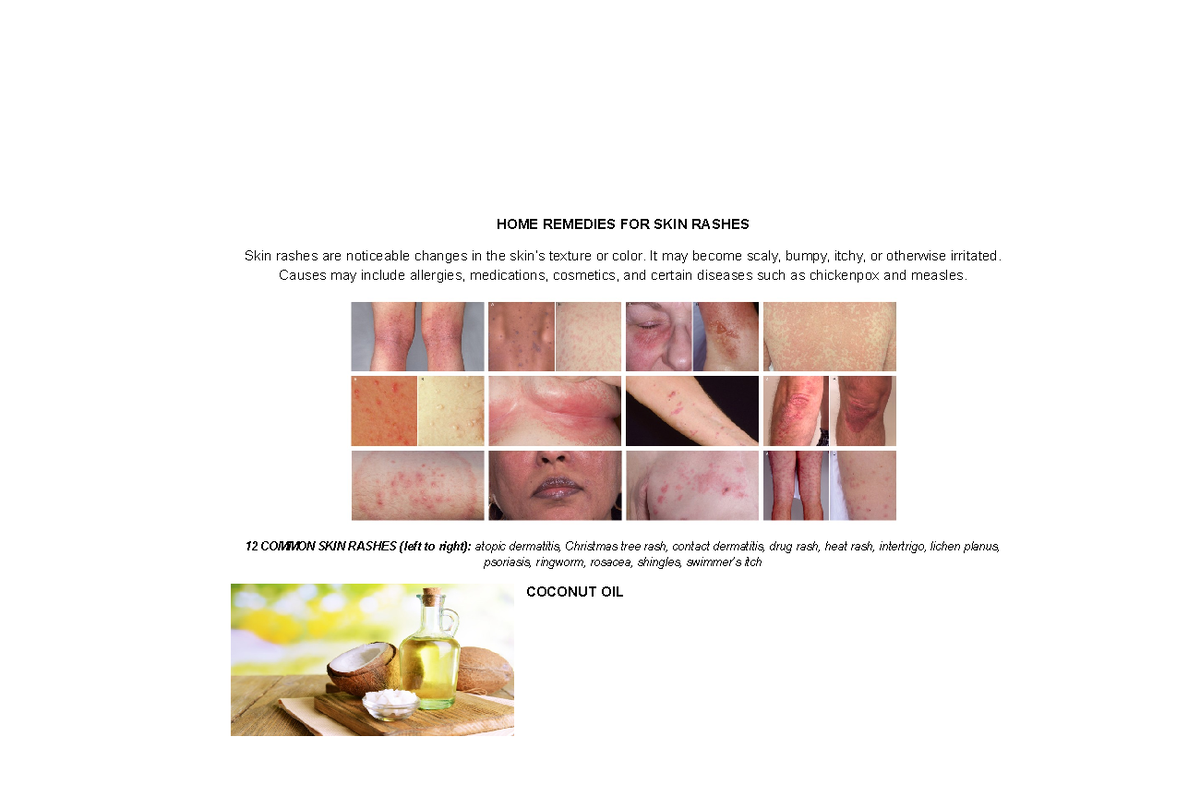 Notes Home Remedies for Skin Rashes HOME REMEDIES FOR SKIN RASHES