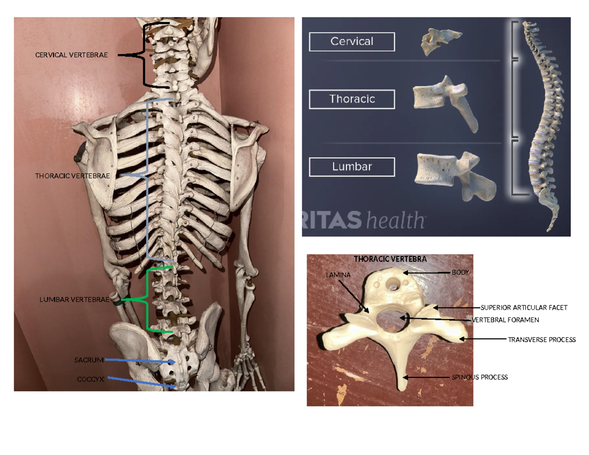 Skeletal- Anatomy - Theoretical foundations in Nursing - CERVICAL ...