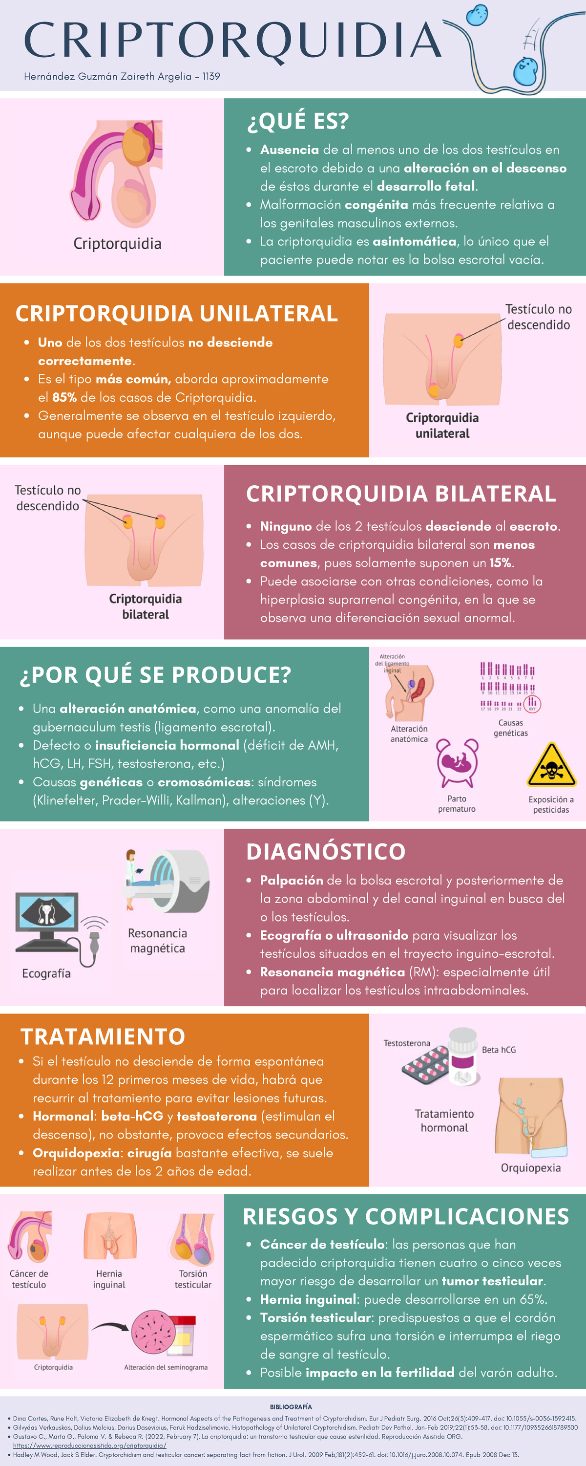 Criptorquidia Testículo no descendido - Infografía - Hernández Guzmán ...