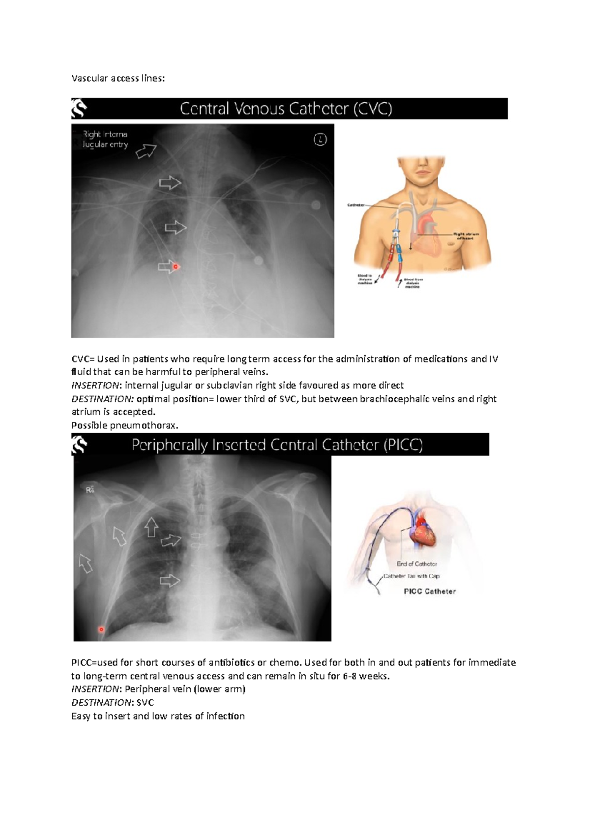 Chest Lines lecture notes Vascular access lines CVC= Used in