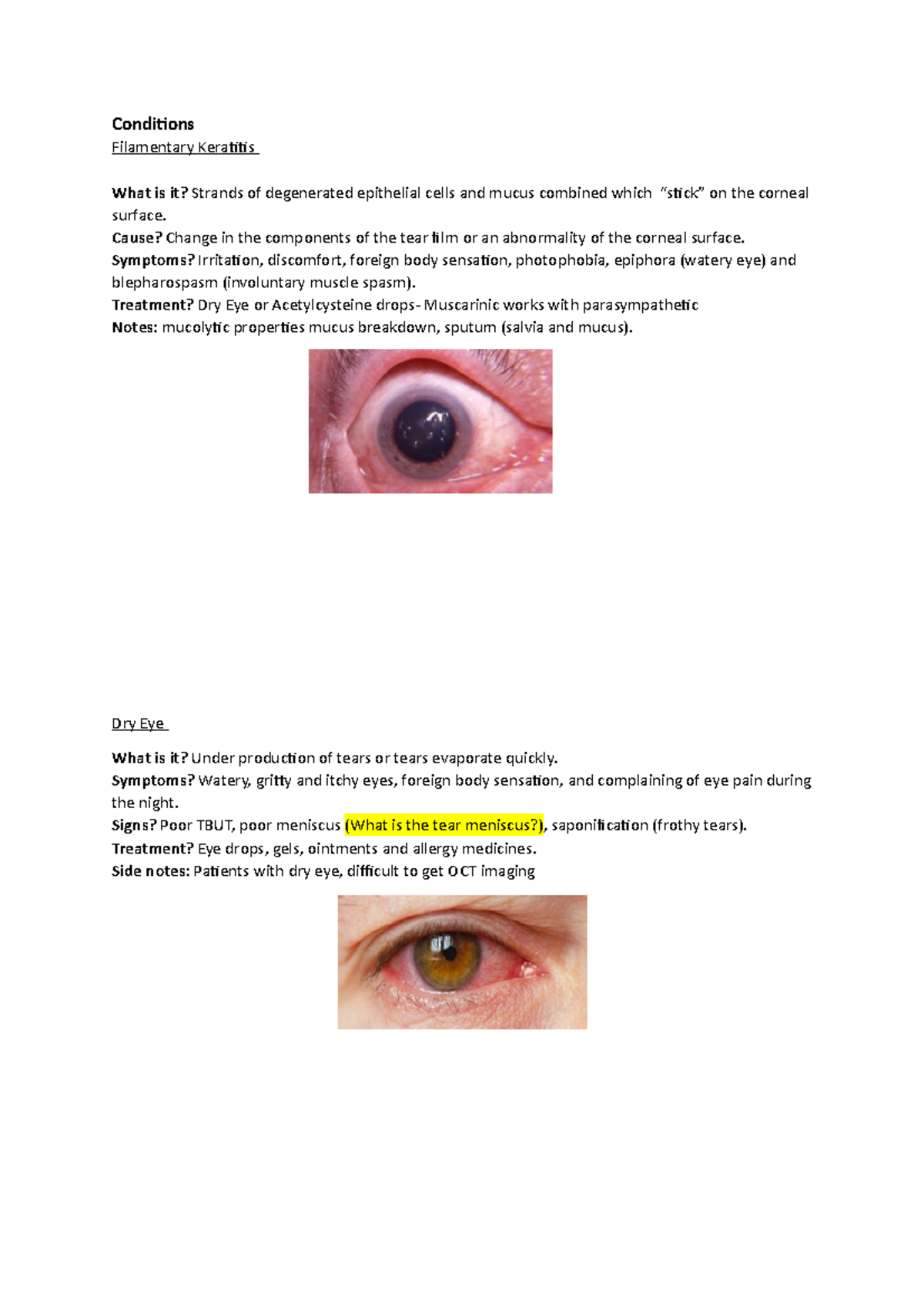 Specsavers Notes - Conditions Filamentary Keratitis What is it? Strands ...