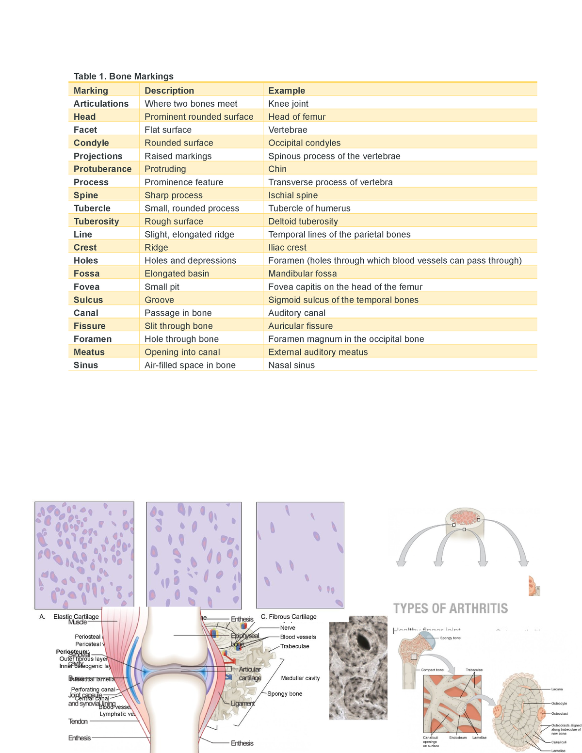 Bone Markings Table 1 Bone Markings Marking Description Example   Thumb 1200 1553 