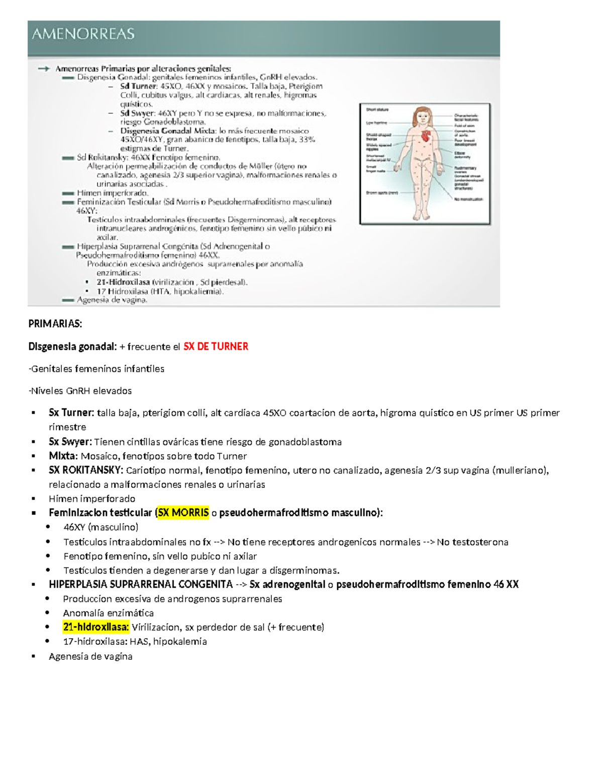 Amenorreas - PRIMARIAS: Disgenesia gonadal: + frecuente el SX DE TURNER ...