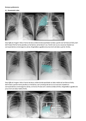 Obstrução intestinal - Obstrução intestinal Íleo funcional – alça ...
