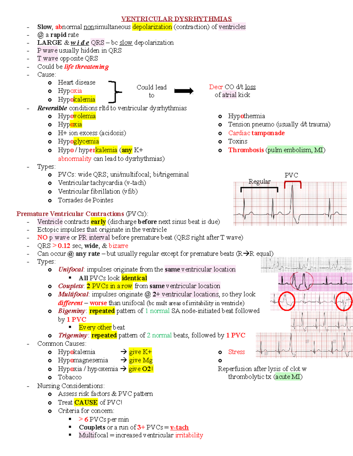 Ventricular Dysrhythmias - VENTRICULAR DYSRHYTHMIAS Slow, abnormal ...