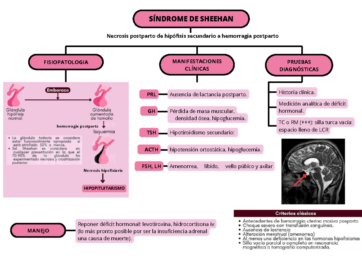 Hemorragia postparto - Bueno - FISIOPATOLOGIA SÍNDROME DE SHEEHAN