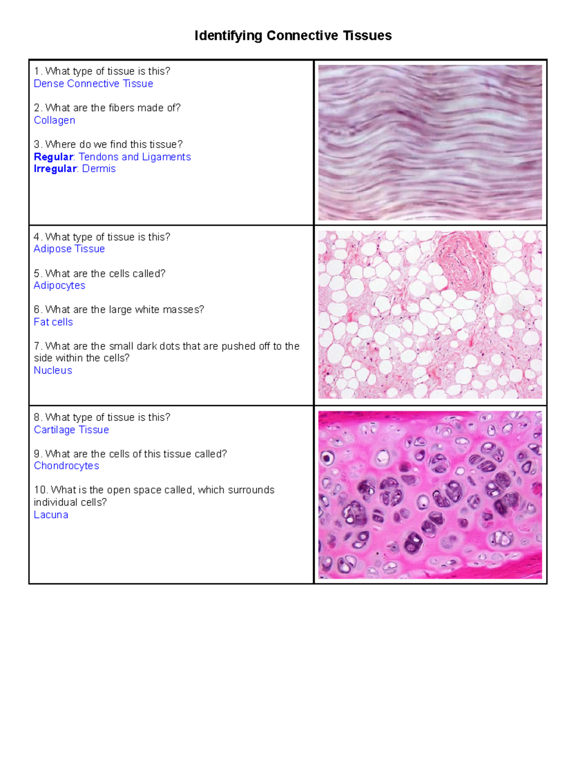 Identifying Connective Tissues Identifying Connective Tissues What