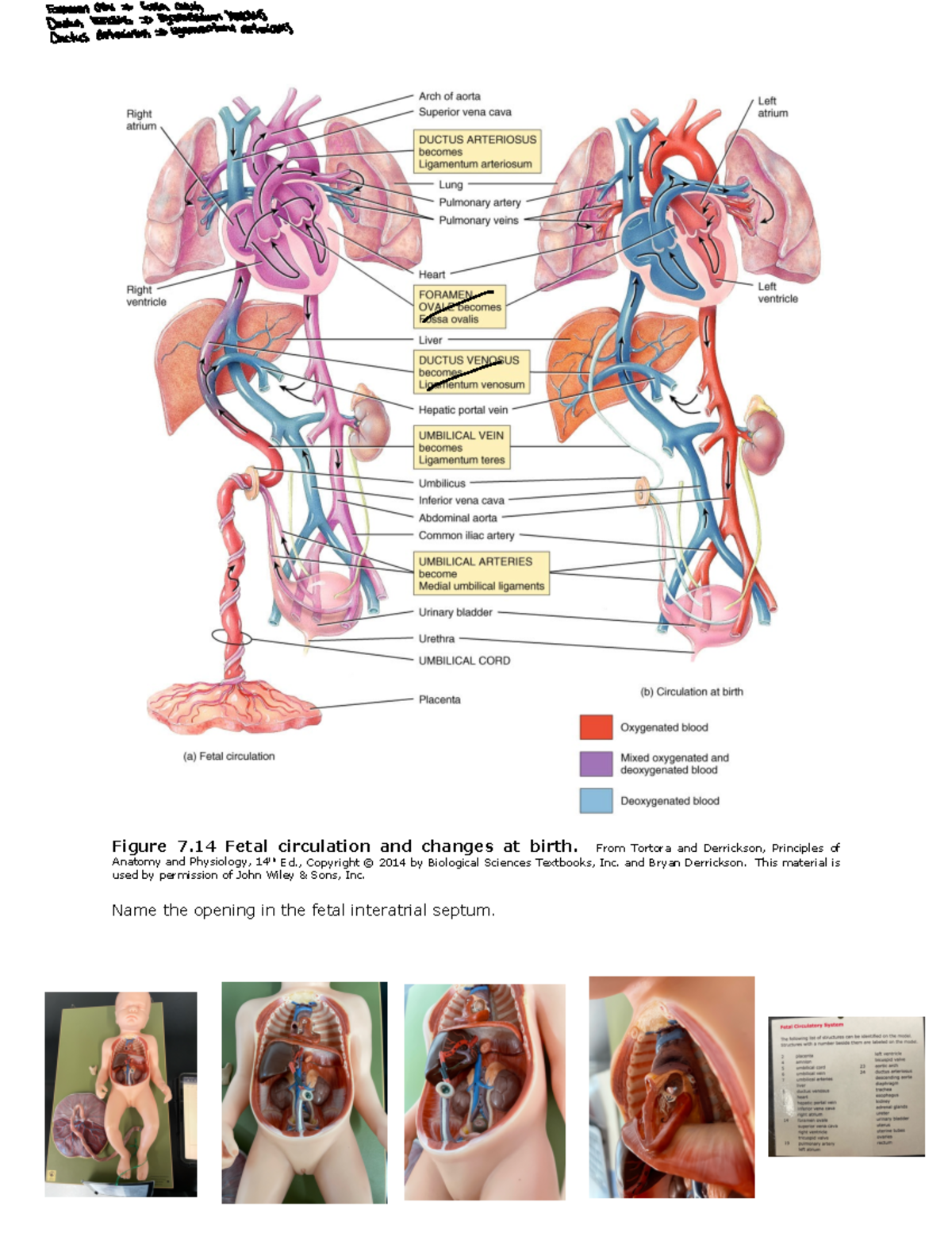 LAB 7 CVS 12 Lab 7 CVS Answer Key 7 Figure 7 Fetal circulation