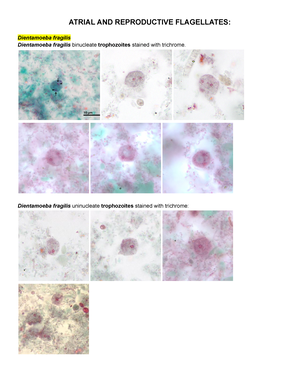 dientamoeba fragilis troph