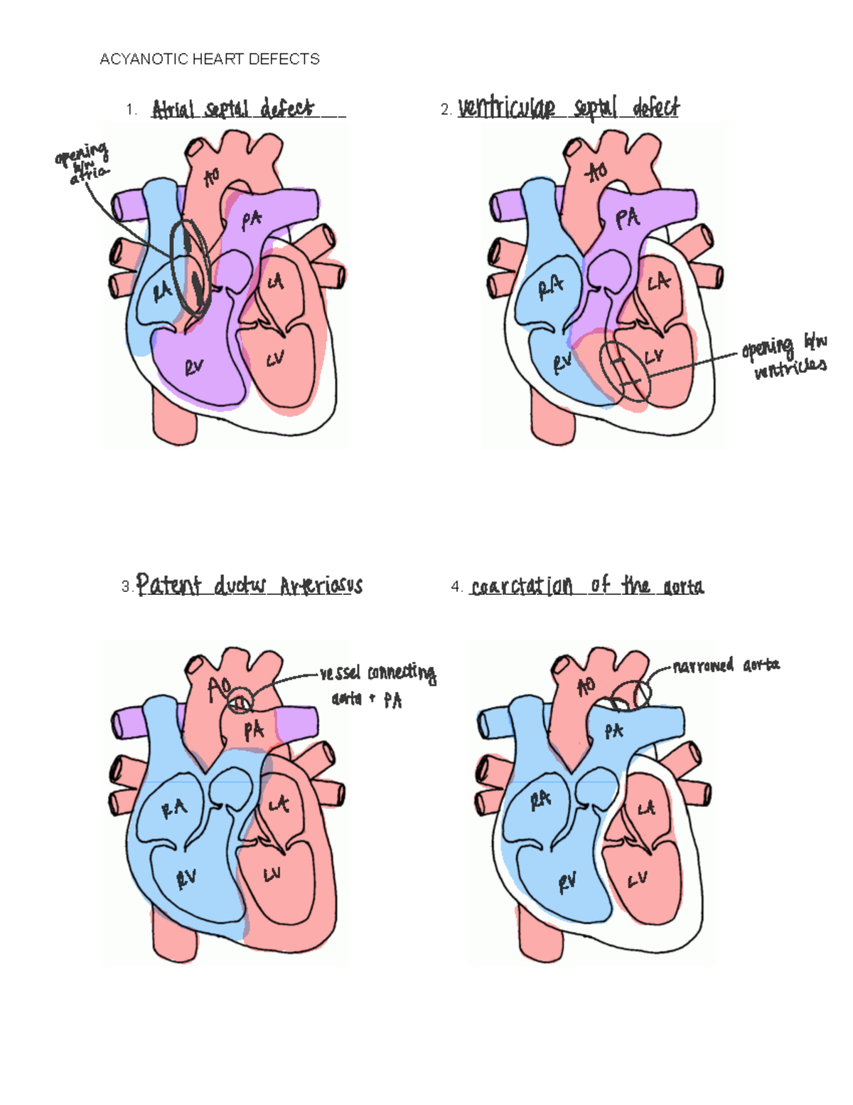 Congenital Heart Defects - ACYANOTIC HEART DEFECTS 1 ...