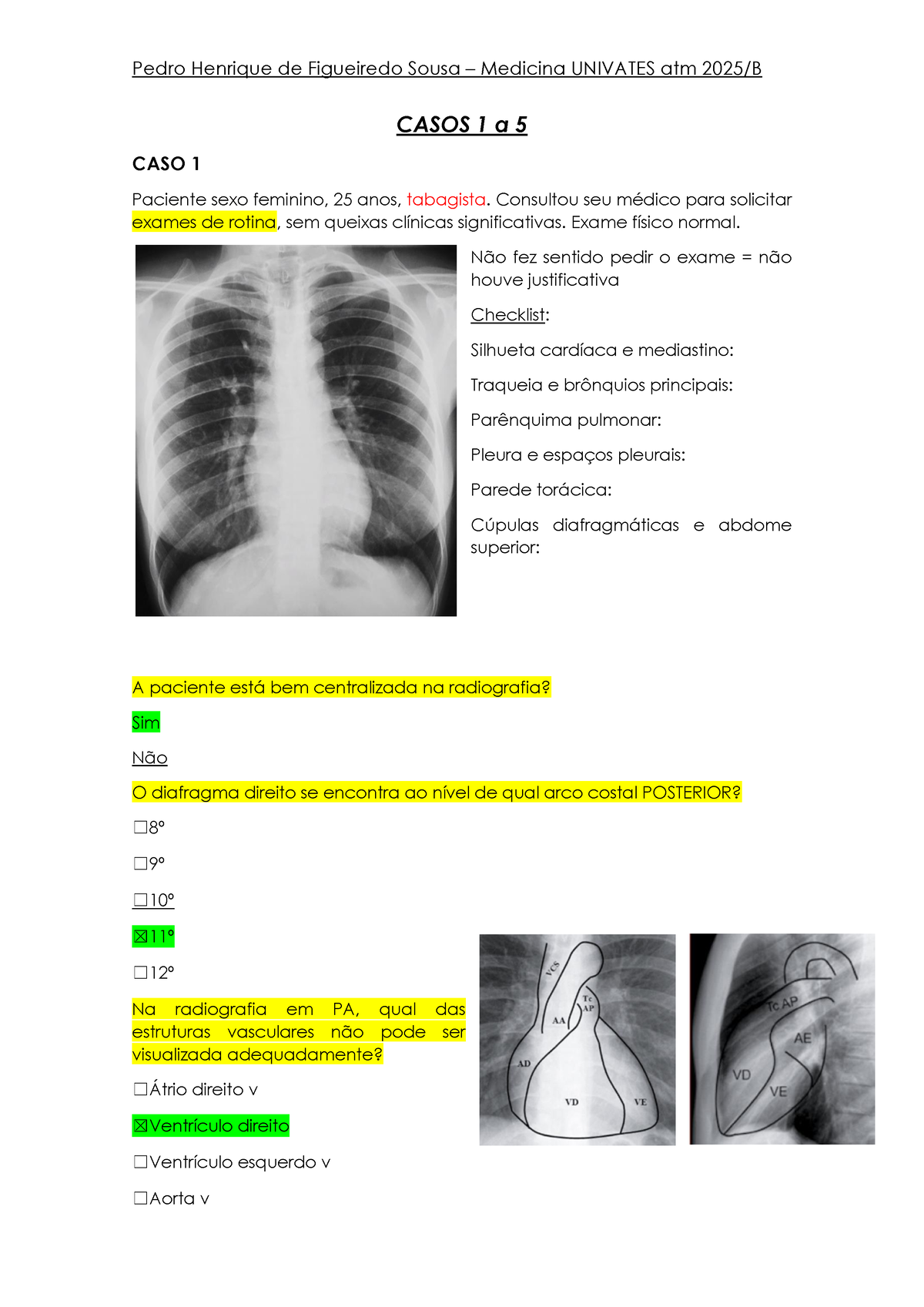 Casos 01 A 05 - Pedro - CASOS 1 A 5 CASO 1 Paciente Sexo Feminino, 25 ...