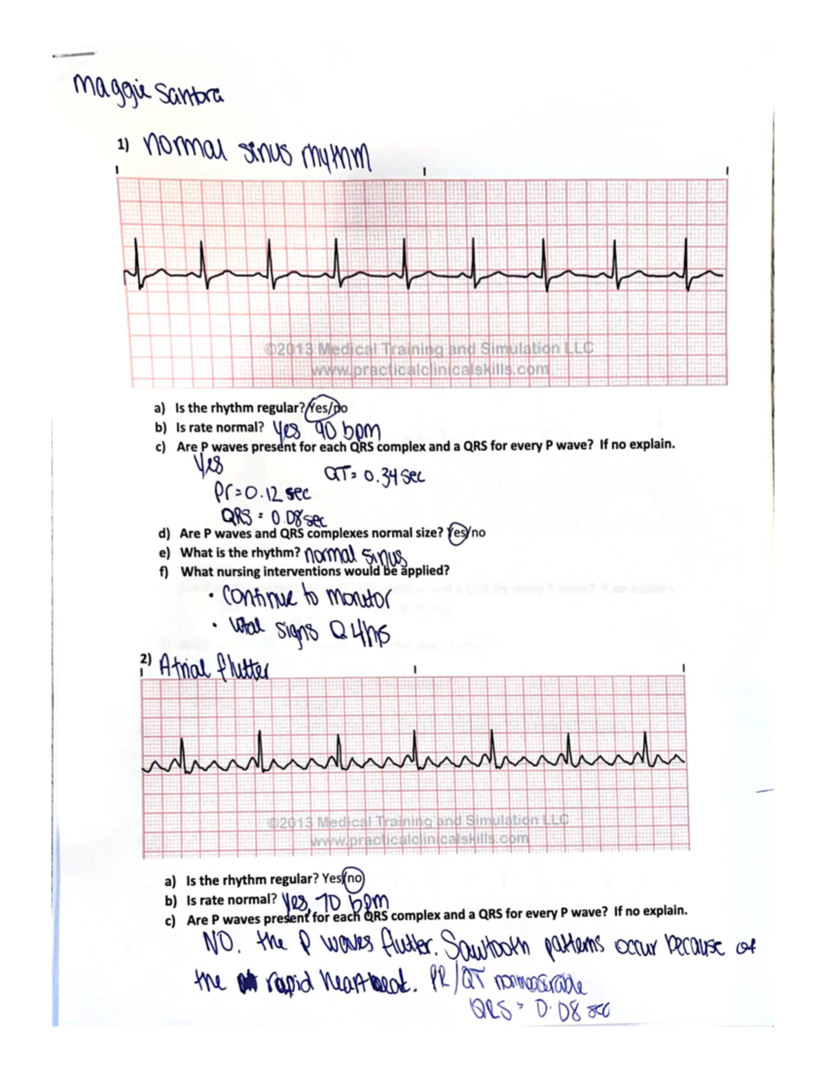 EKG quiz - EKG rhythm strips quiz - NR-341 - Studocu