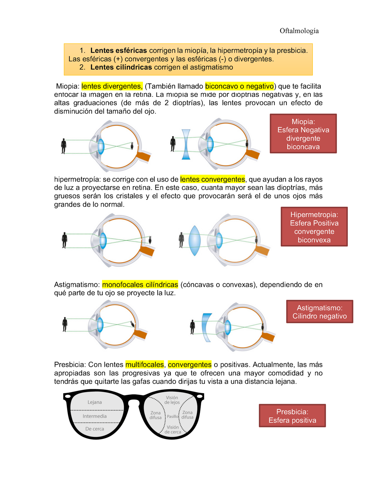 trama Surrey hijo Tipos de lentes - Giraldi Yasareth Vidal Sánchez Oftalmología Miopía :  lentes divergentes, (también - Studocu