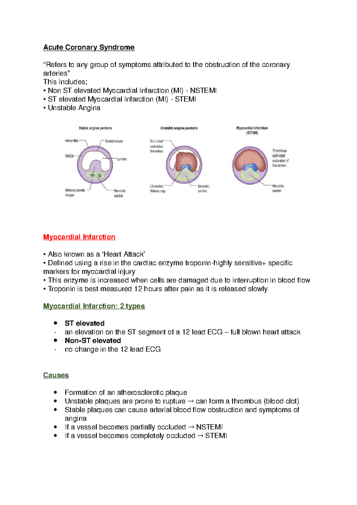 Acute Coronary Syndrome - Acute Coronary Syndrome “Refers to any group ...