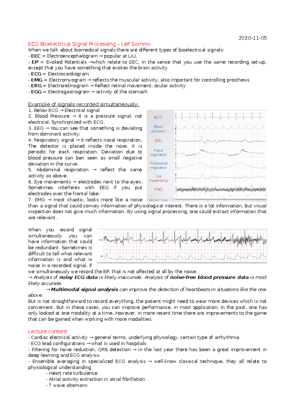 Lecture 2 - ECG Signal Processing - 2020-11- ECG Bioelectrical Signal ...