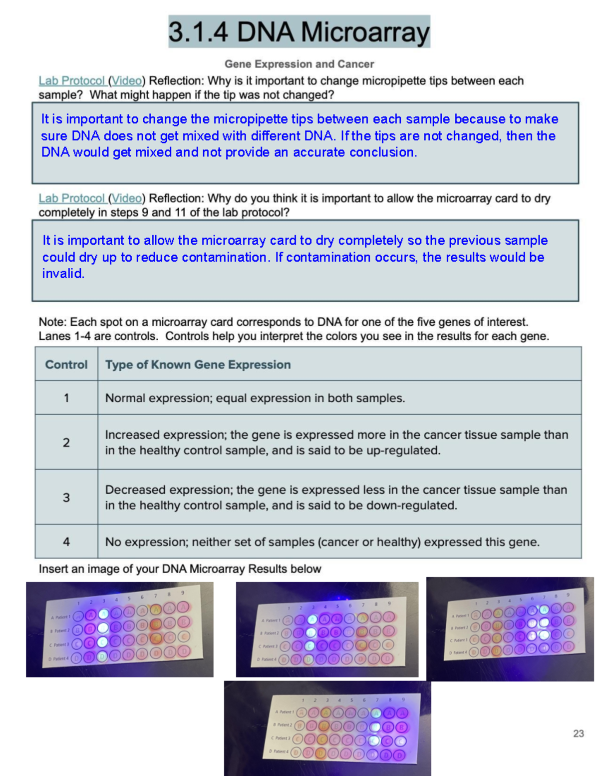 Microarray Lab 2nd submission 3.1 DNA Microarray Gene Expression and