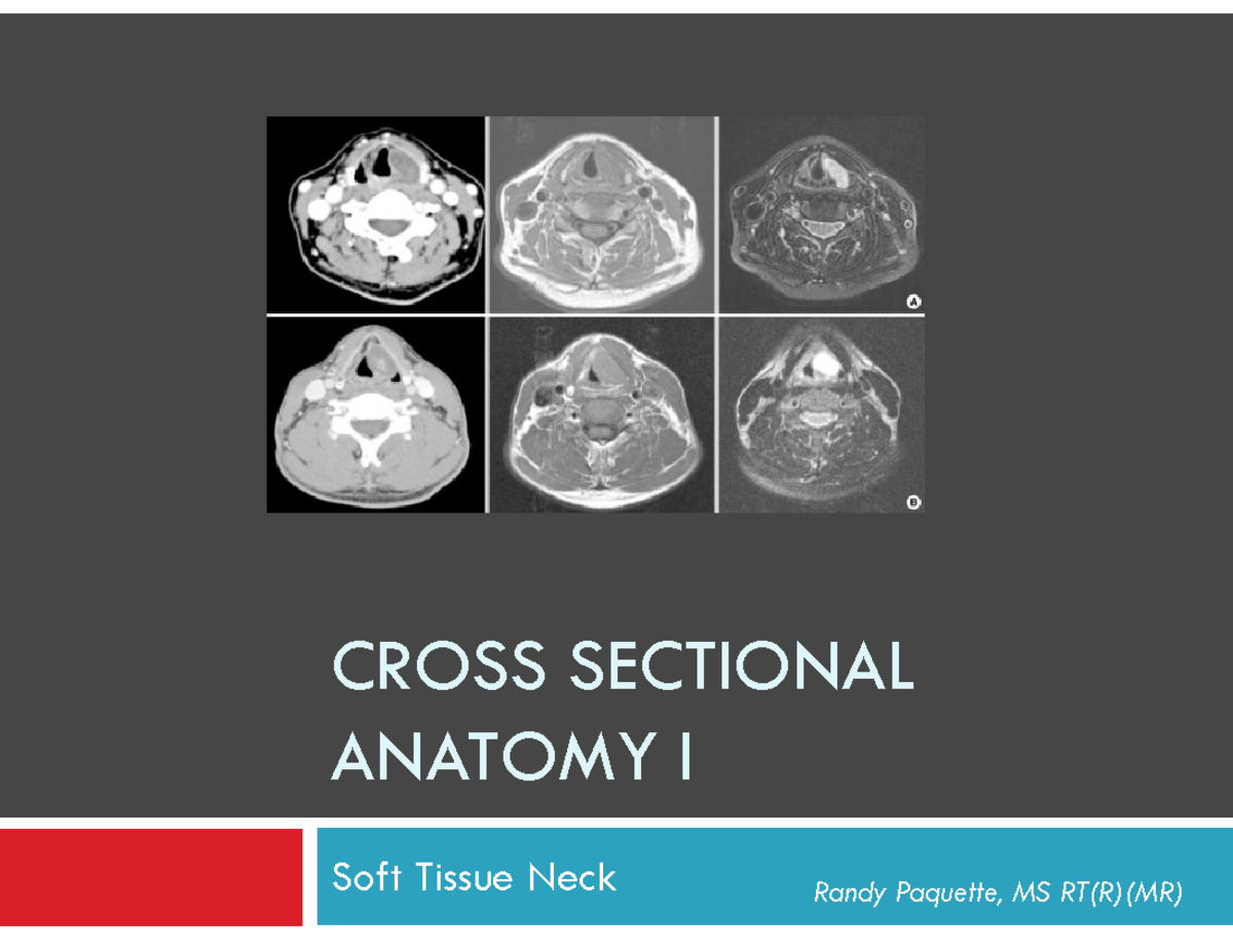 Soft Tissue Neck Anatomy - CROSS SECTIONAL ANATOMY I Soft Tissue Neck ...