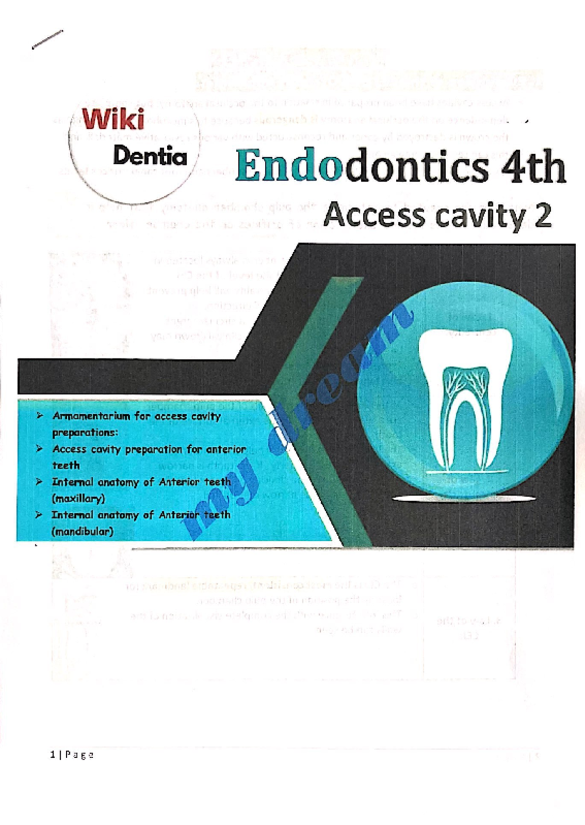 [Endo] Access Cavity Part 2 - Wiki Dentia Endodontics 4th Access cavity ...