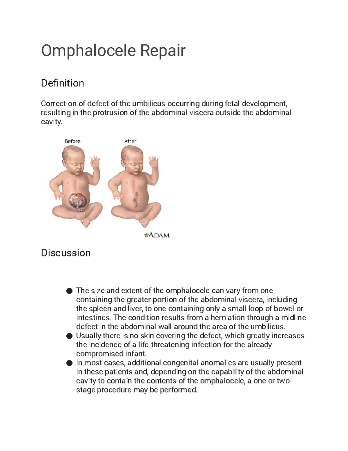 The Unexpected Causes Of Omphalocele: A Medical Mystery - u33snmk