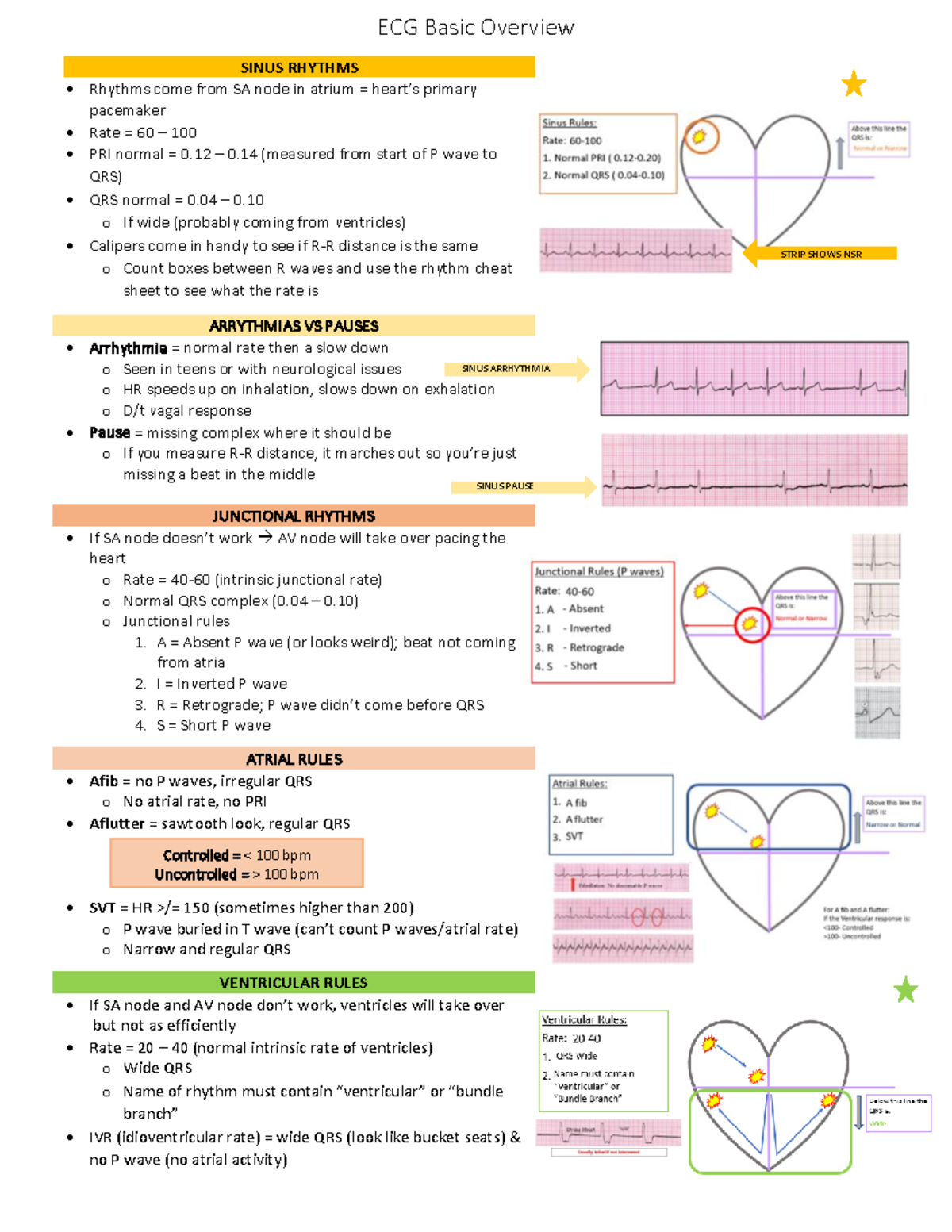 ECG Basics - Learn ECG - ECG Basic Overview SINUS RHYTHMS Rhythms come ...