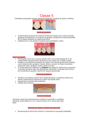 Preparo De Cavidade Classe Iv Simples Para Resina Composta Classe Faces Proximais Dos Dentes