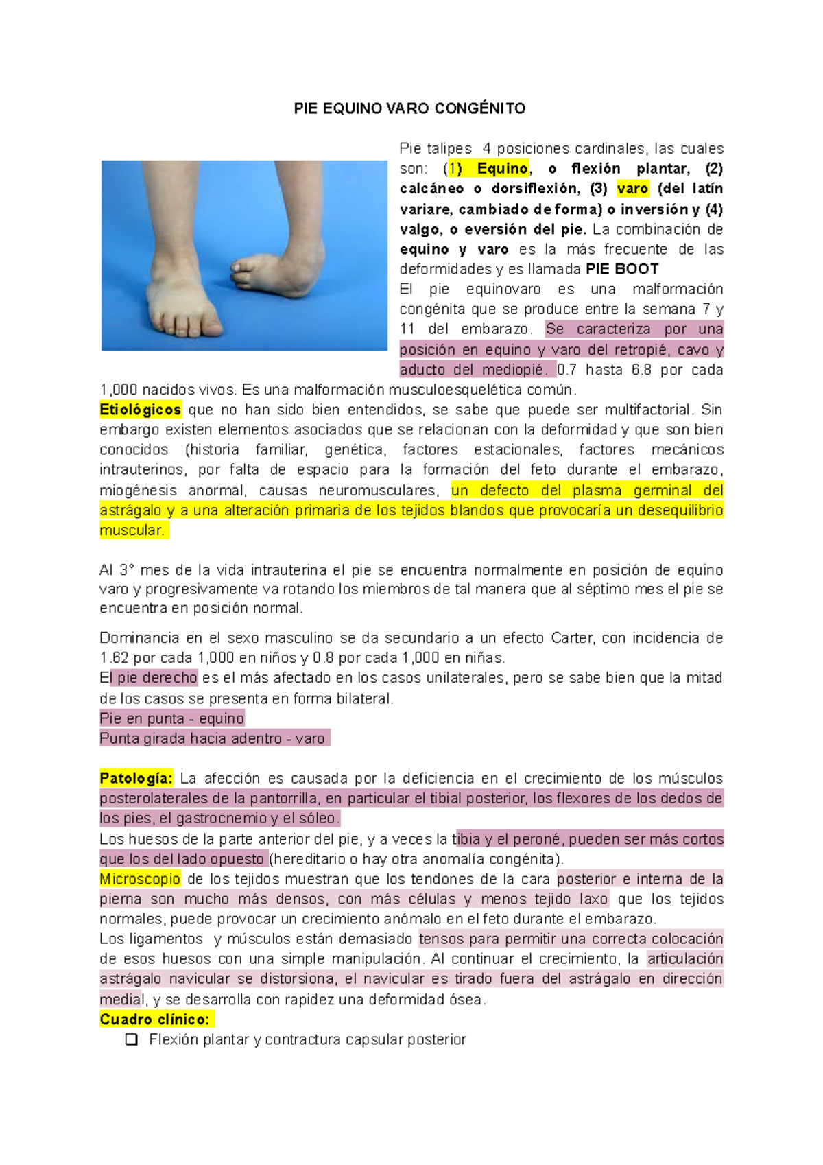 Pie equinovaro congenito PIE EQUINO VARO CONGÉNITO Pie talipes 4