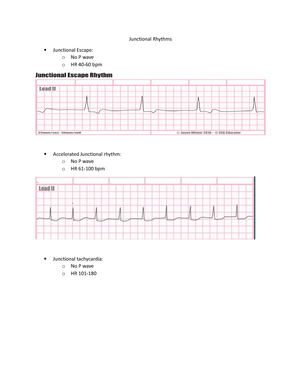 Junctional Rhythms