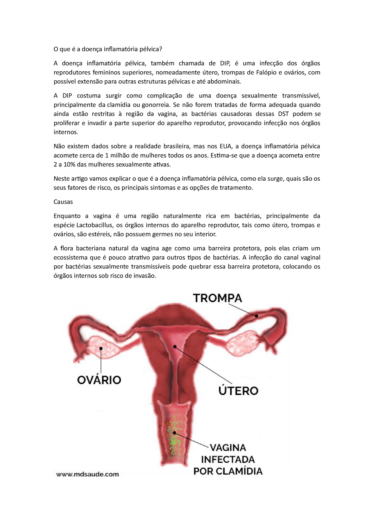 Dr. Carlos Roberto - Ginecologia - A DIPA (Doença Inflamatória Pélvica  Aguda) é uma infecção dos órgãos reprodutivos femininos (útero, trompas e  ovários). ▫ A DIPA ocorre quando bactérias patogênicas proliferam na