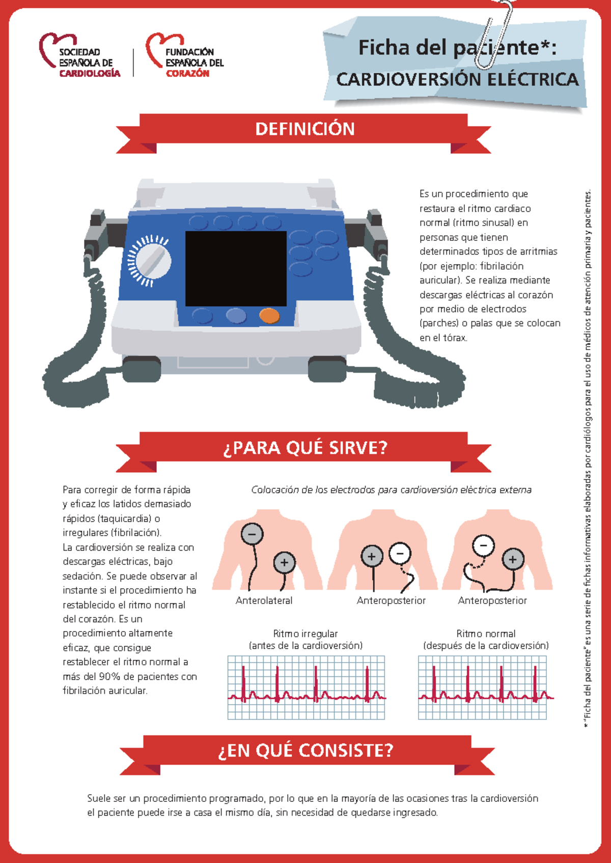 Cardioversion - Es un procedimiento que restaura el ritmo cardiaco ...