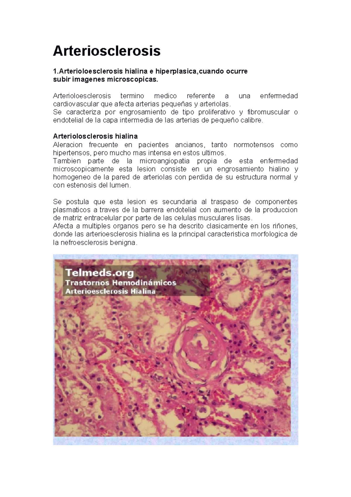Presentación de arteroesclerosis Arteriosclerosis 1 hialina e