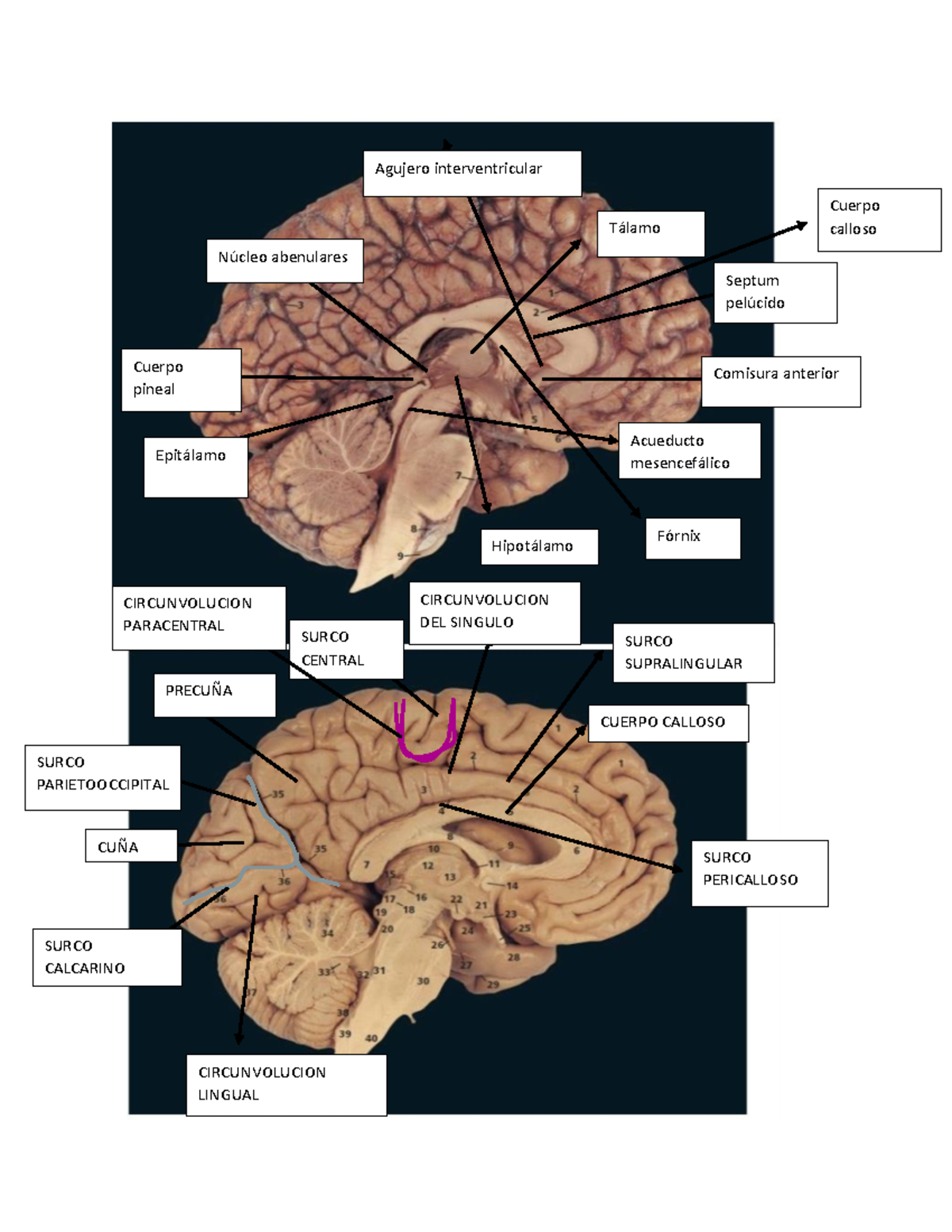 Examen Final. Neuro-convertido - CUERPO CALLOSO SURCO PARIETOOCCIPITAL ...