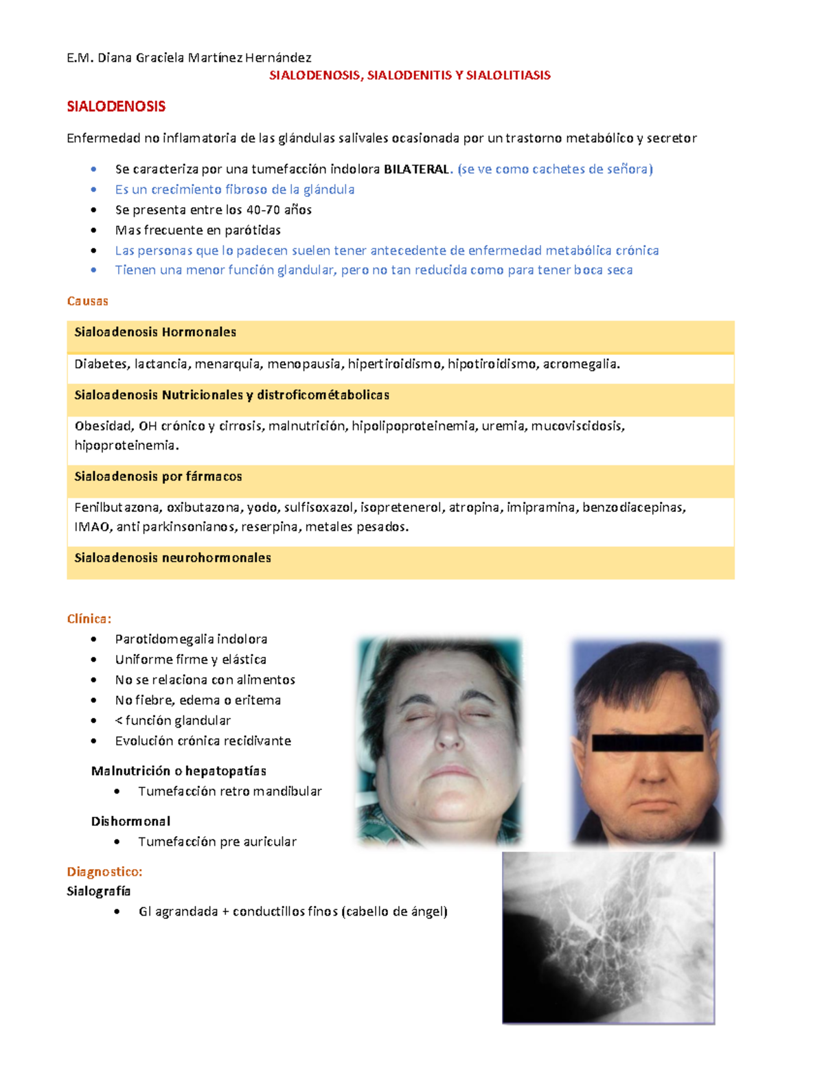 sialolitiasis sintomas de diabetes