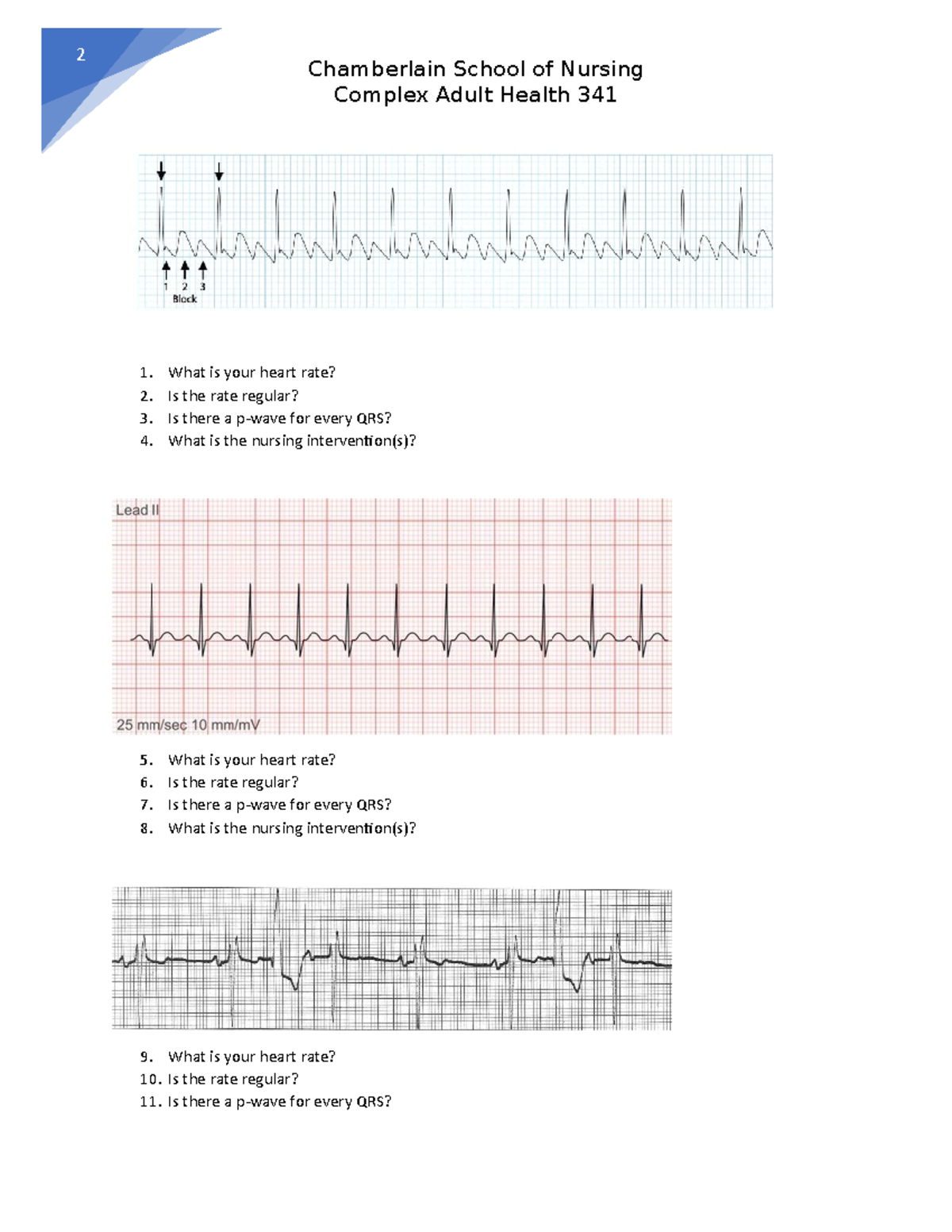 341 Cardiac Rhythm Strips Chamberlain School of Nursing Complex Adult