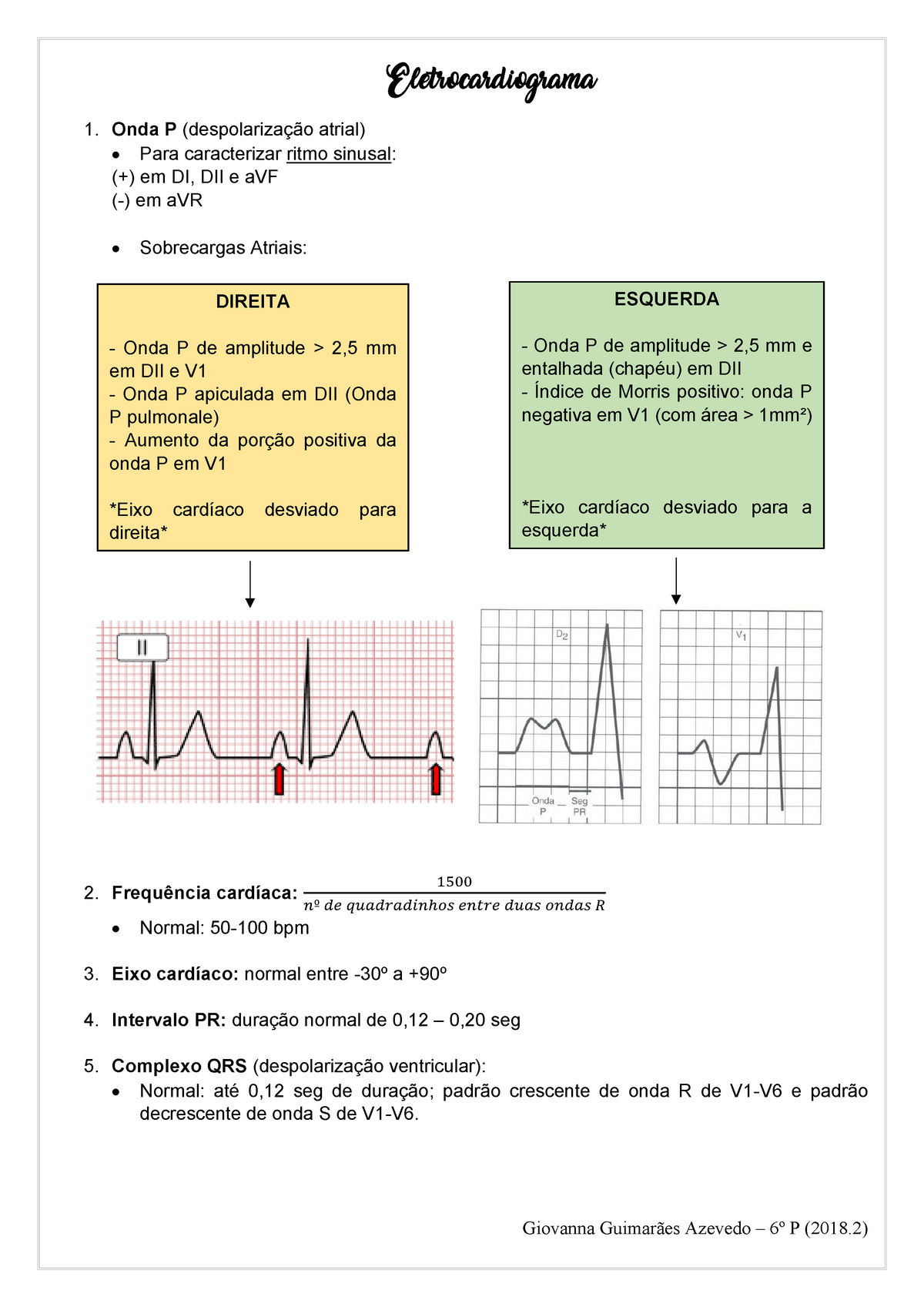 Resumos Pf Cardio Eletrocardiograma 1 Onda P Atrial Para Caracterizar Ritmo Sinusal Em Di 4588